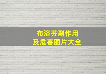 布洛芬副作用及危害图片大全